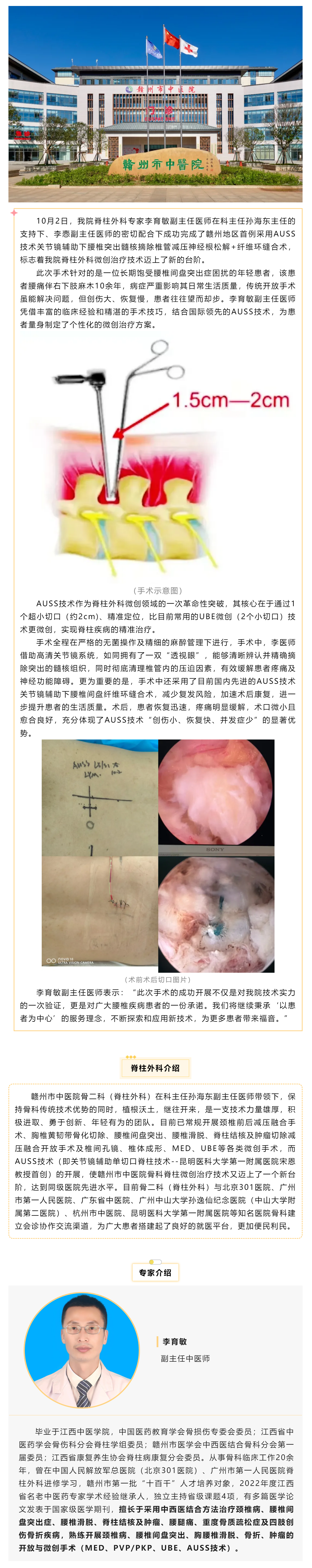 全市首例！我院成功實(shí)施AUSS技術(shù)關(guān)節(jié)鏡輔助下腰椎突出髓核摘除椎管減壓神經(jīng)根松解+纖維環(huán)縫合術(shù).png